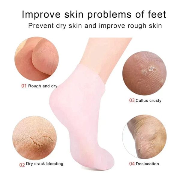 Silicon Socks: Say goodbye to cracked heels!