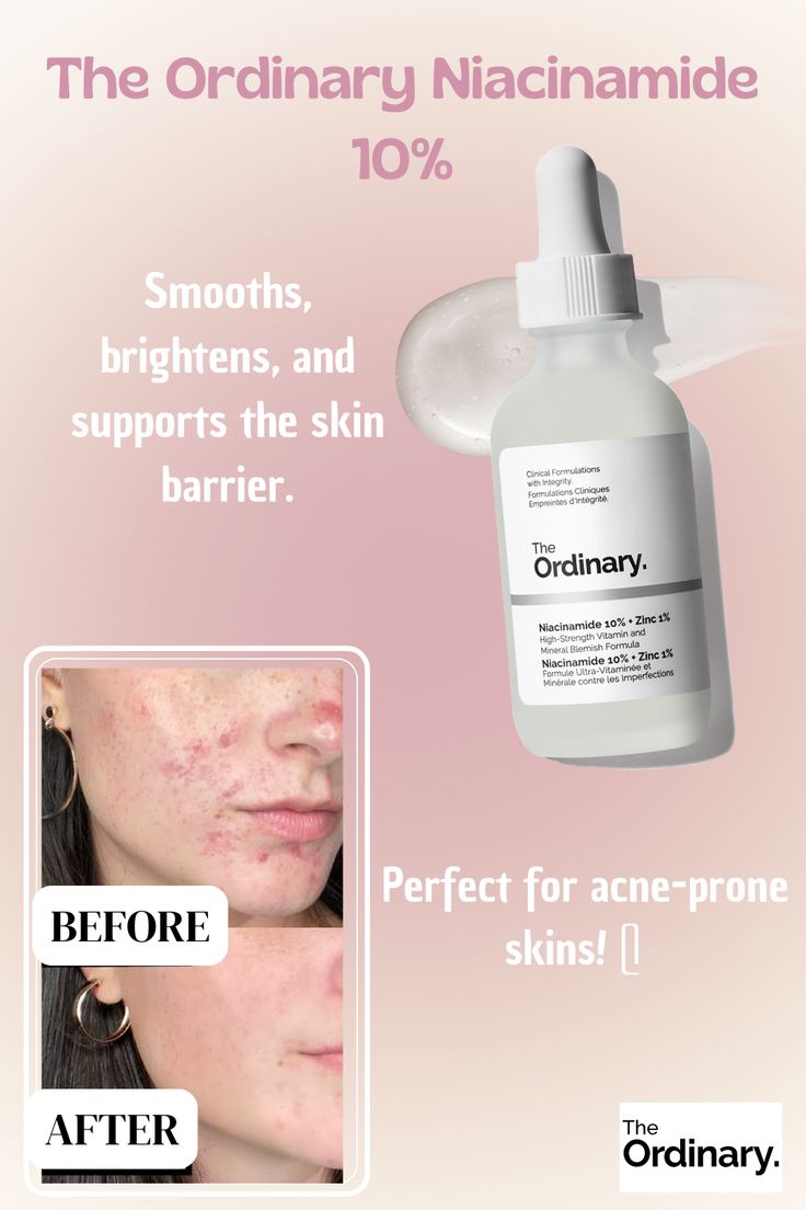 the Ordinary Niacinamide + Zinc Skin Care Cosmetics 10% 1% 10ml